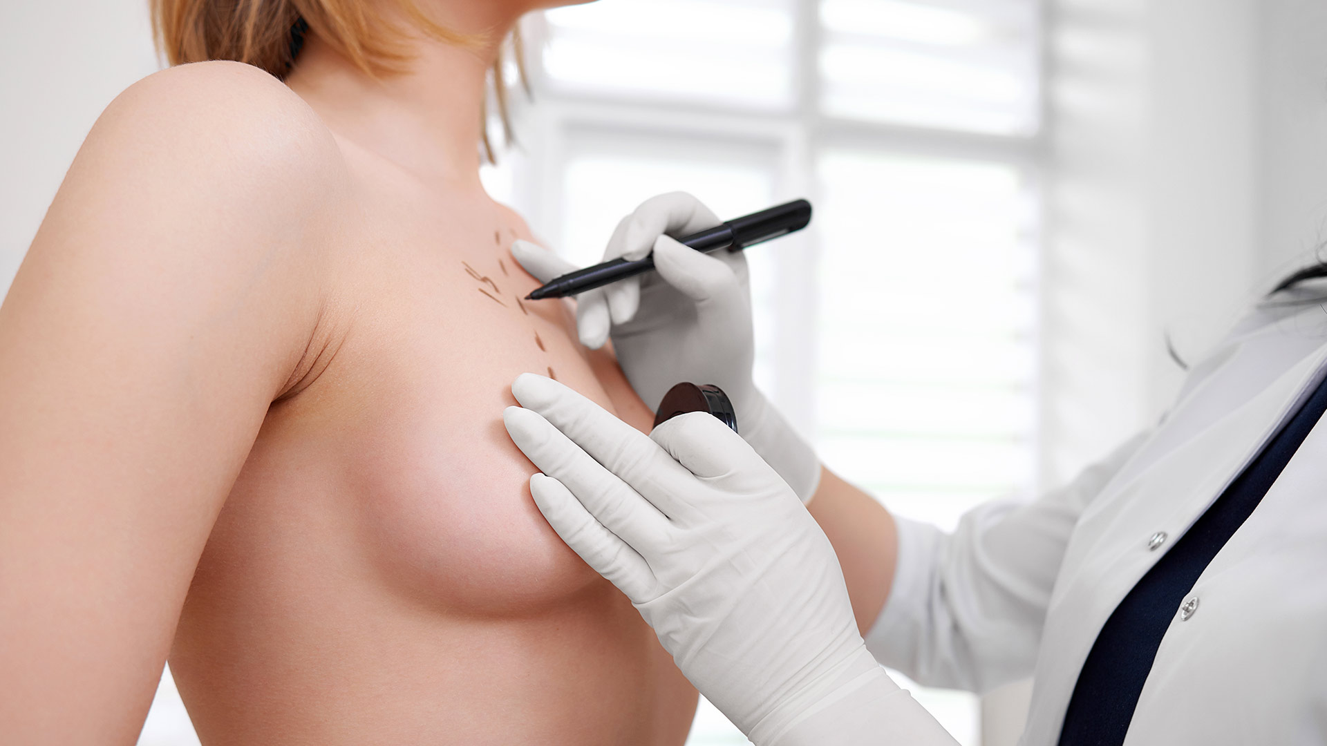 What Is the Recovery Time for a Breast Augmentation?